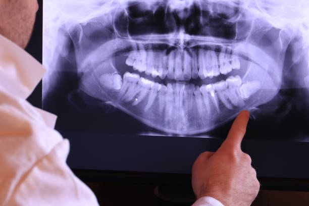 Best Emergency Tooth Extraction in Graysville, TN