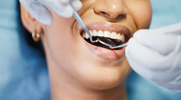 Best Walk-In Emergency Dentist in Graysville, TN