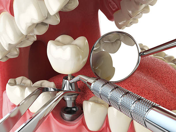Best Emergency Treatment for Toothache in Graysville, TN